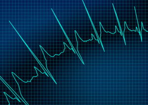 Hospital Vital Signs Monitor 