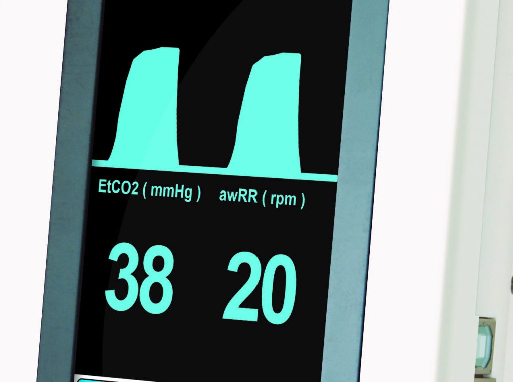 Capnography Waveform