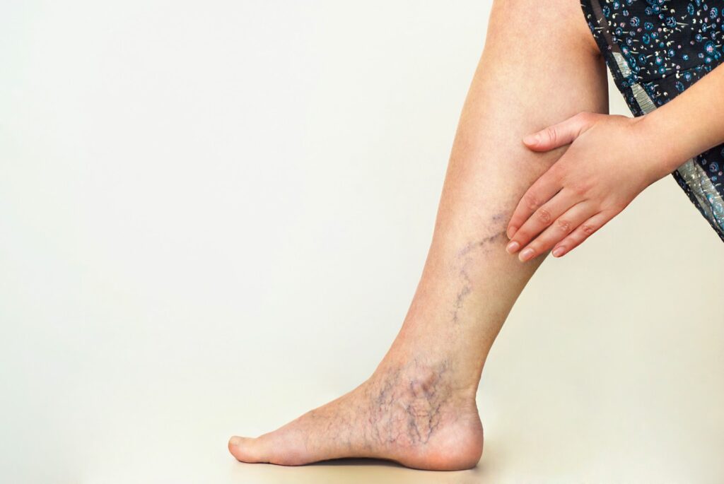 How Does It Work: Vein Viewers