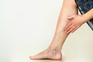How Does It Work: Vein Viewers