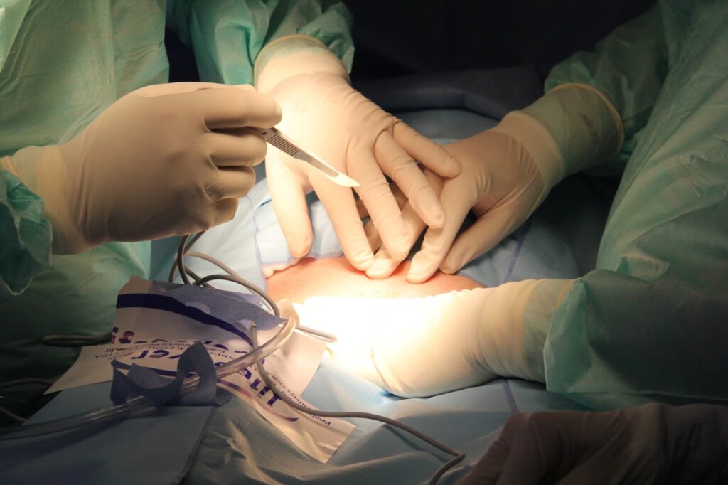 medical operating equipment