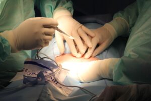 medical operating equipment