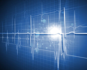 ECG Machine