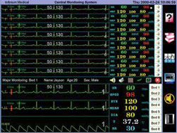 central-monitoring